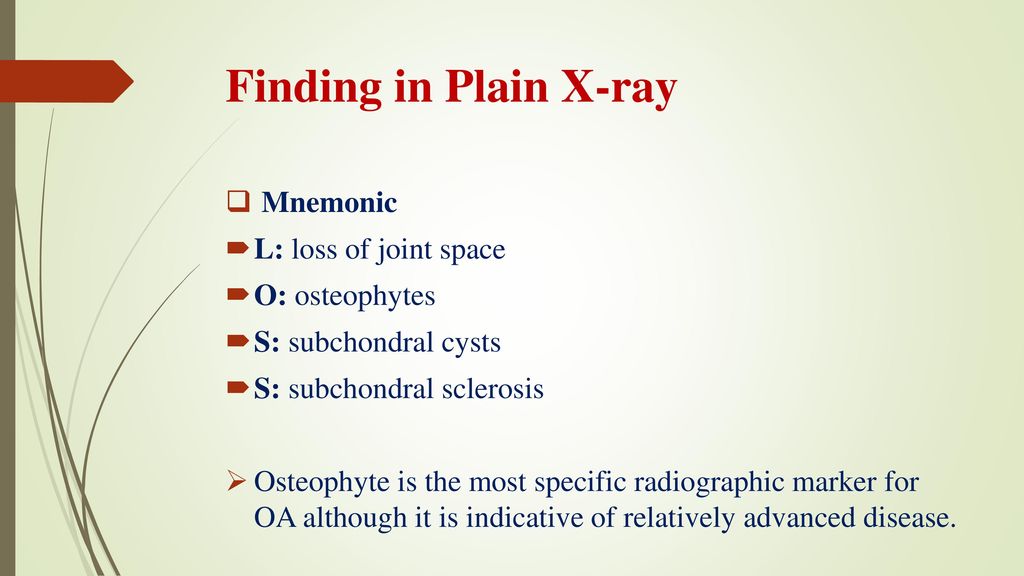 Osteoarthritis Ppt Download