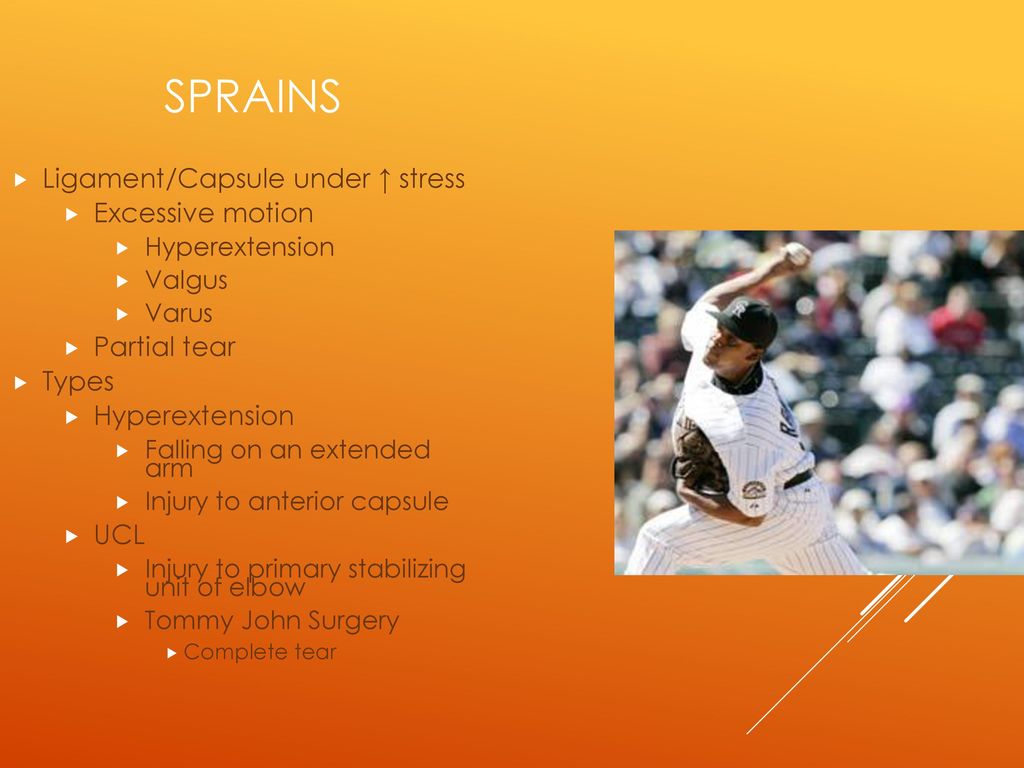 Sprains Ligament/Capsule under ↑ stress Excessive motion Partial tear