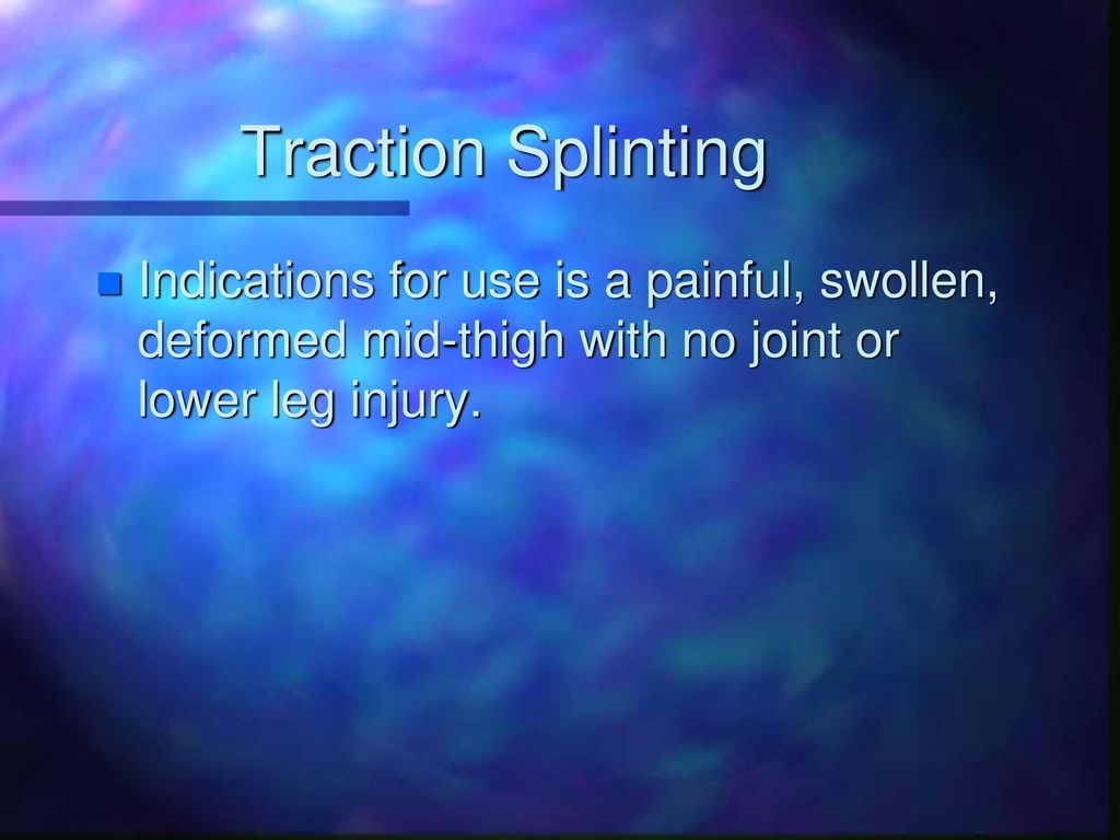 Traction Splinting Indications for use is a painful, swollen, deformed mid‑thigh with no joint or lower leg injury.
