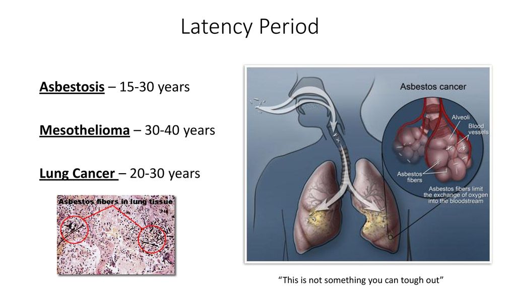Latency Period Asbestosis – years Mesothelioma – years