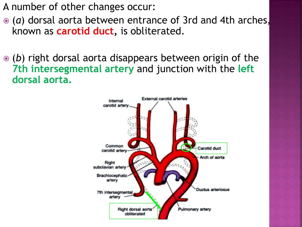 Development Of The Aortic Arches Ppt Download