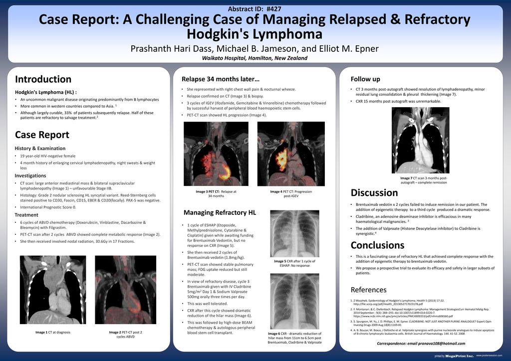 Abstract Id 427 Case Report A Challenging Case Of Managing