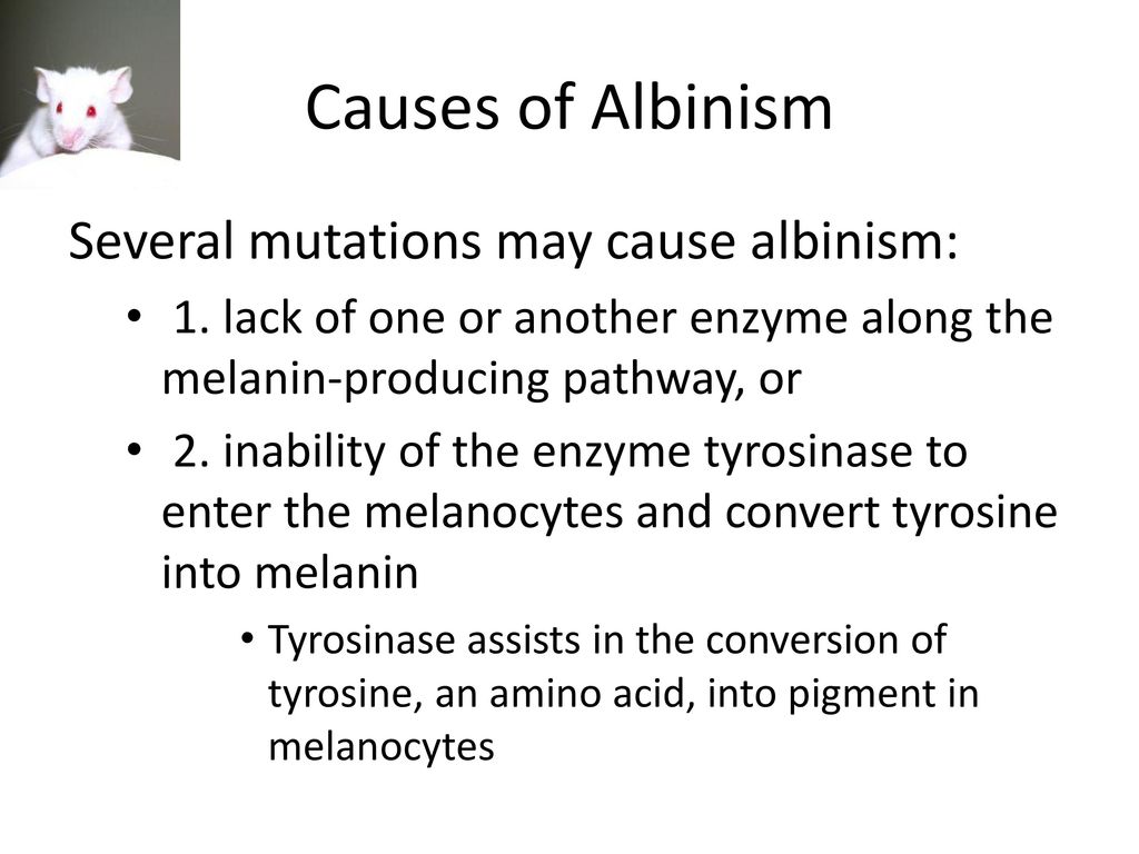 Causes of Albinism Several mutations may cause albinism: