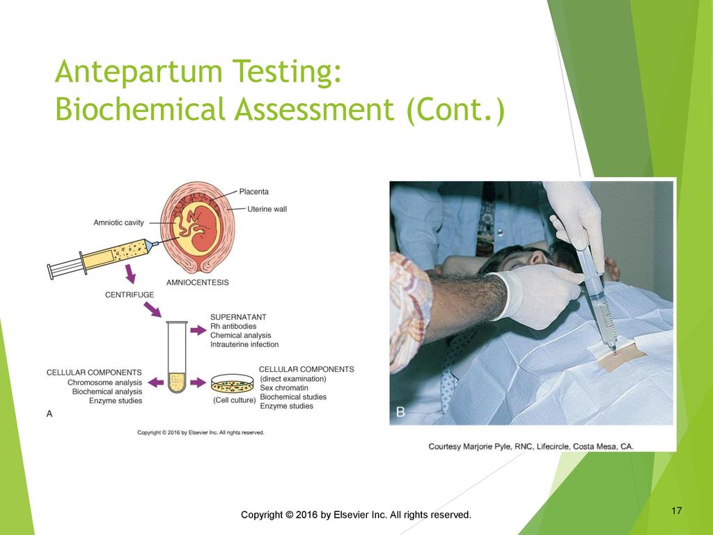 Antepartum Testing: Biochemical Assessment (Cont.)