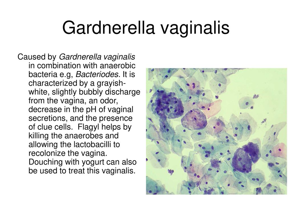 Gardnerella vaginalis.