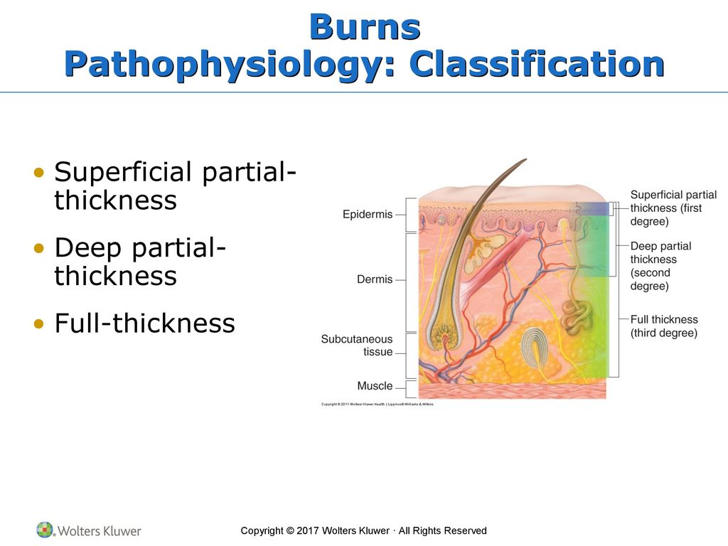 Lines Of Defense First: Skin And Mucous Membranes - Ppt Download