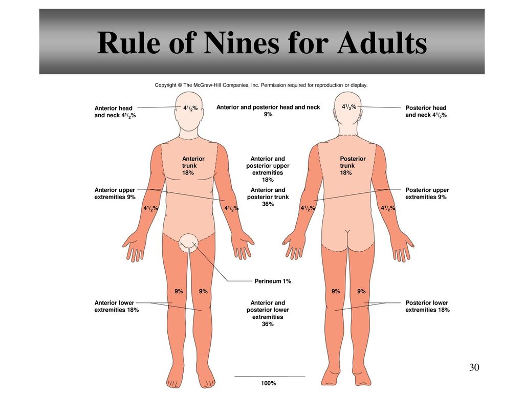Rule of Nines for Adults
