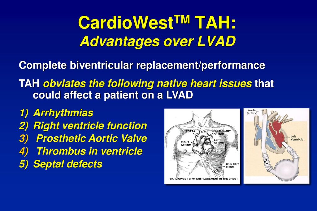 The SynCardia CardioWestTM Total Artificial Heart - ppt download