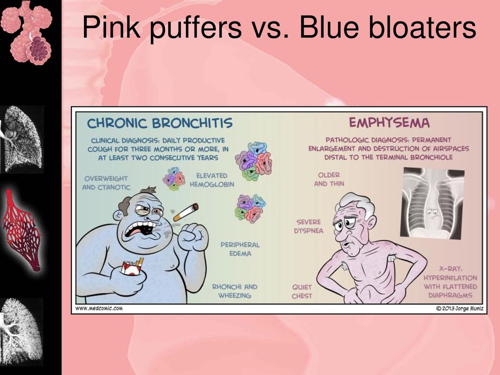 The RESPIRATORY System - Ppt Download