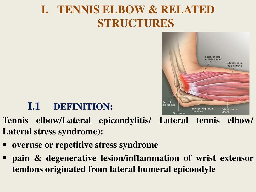 TENNIS ELBOW & PHYSICAL THERAPY - ppt download