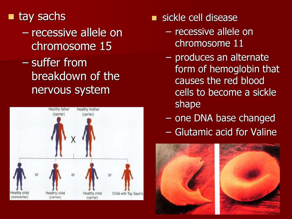 recessive allele on chromosome 15