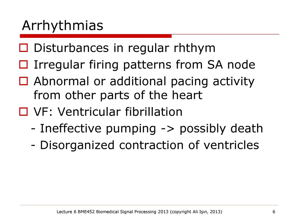 BME 452 Biomedical Signal Processing - ppt download