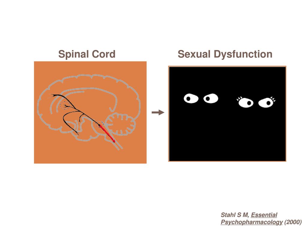 Spinal Cord Sexual Dysfunction