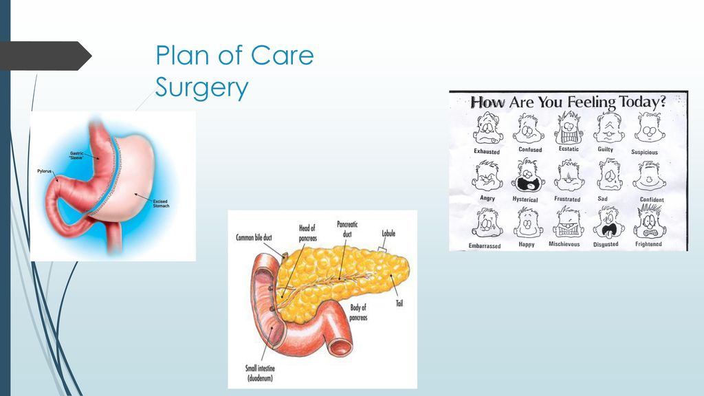 Plan of Care Surgery Plan of Care Bariatric surgery-DM 2