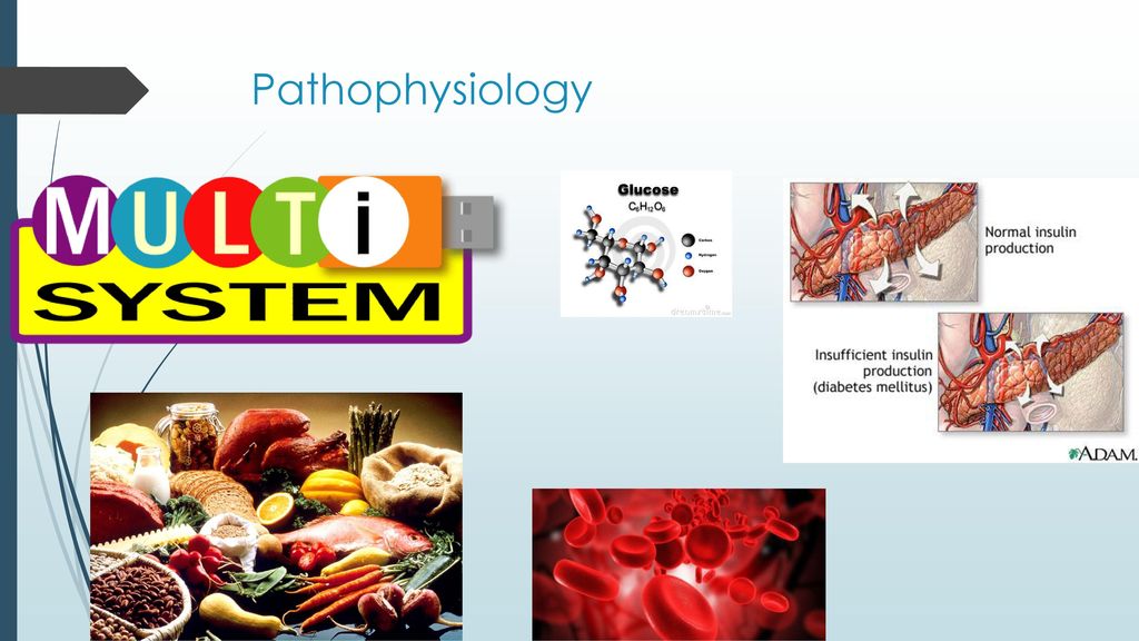 Pathophysiology Multisystem disorder