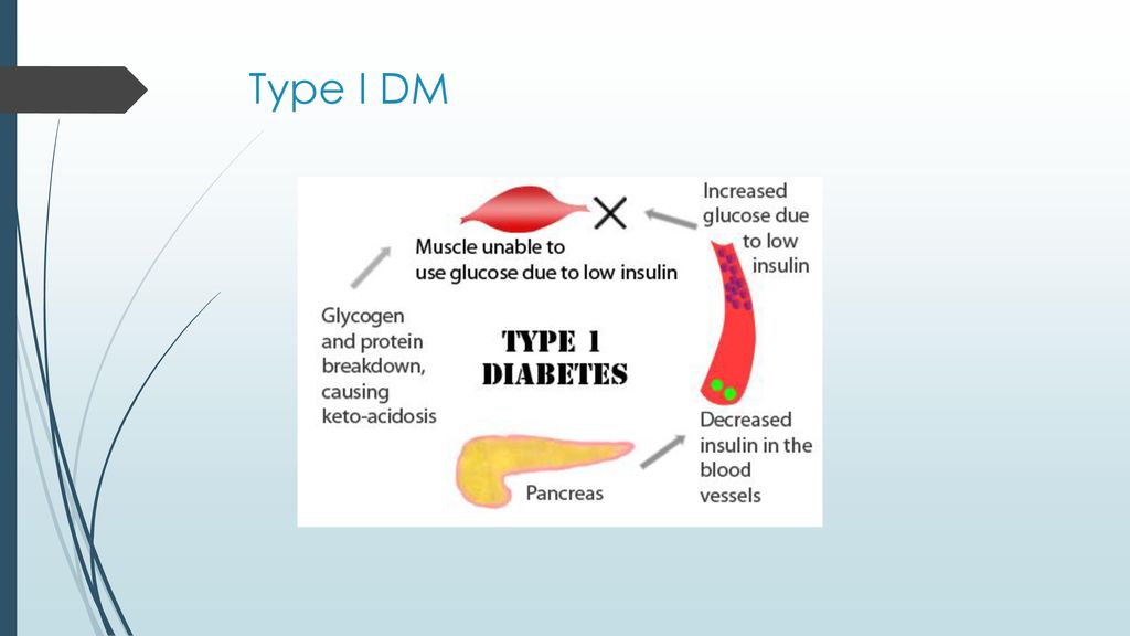 Type I DM 1. Type 1 DM. Formally known as juvenile onset or insulin dependent DM. Autoimmune disorder-body develops antibodies against B-cells.