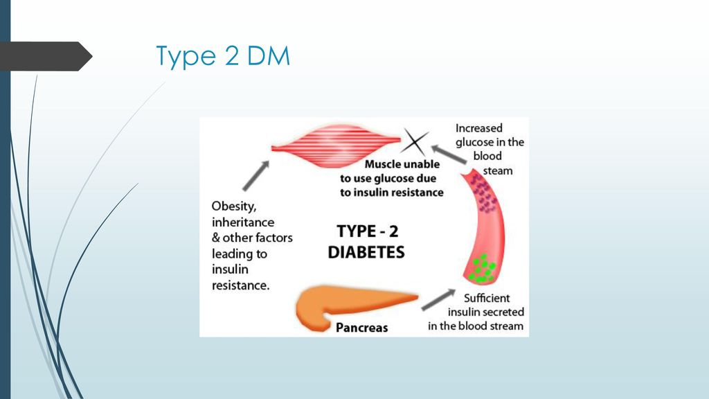 Type 2 DM 2. Type 2 DM Used to be referred to as AODM, or NIDDM