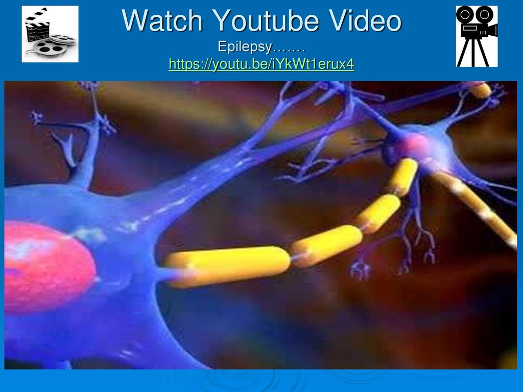 Watch Youtube Video Epilepsy…….