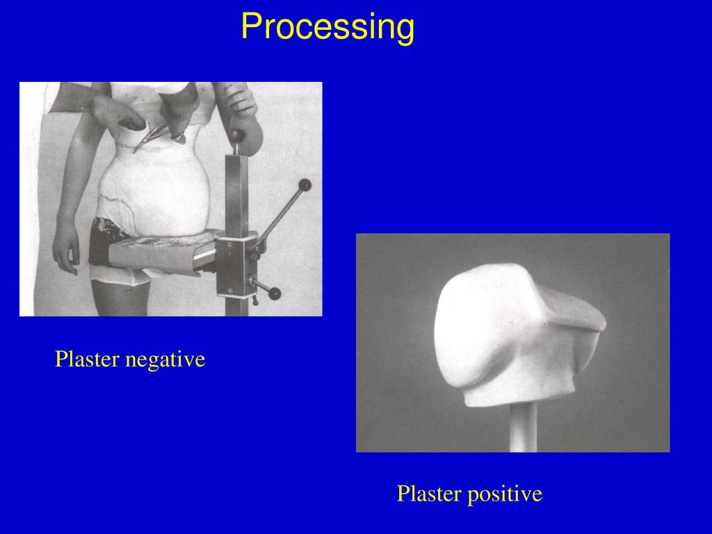 Processing Plaster negative Plaster positive