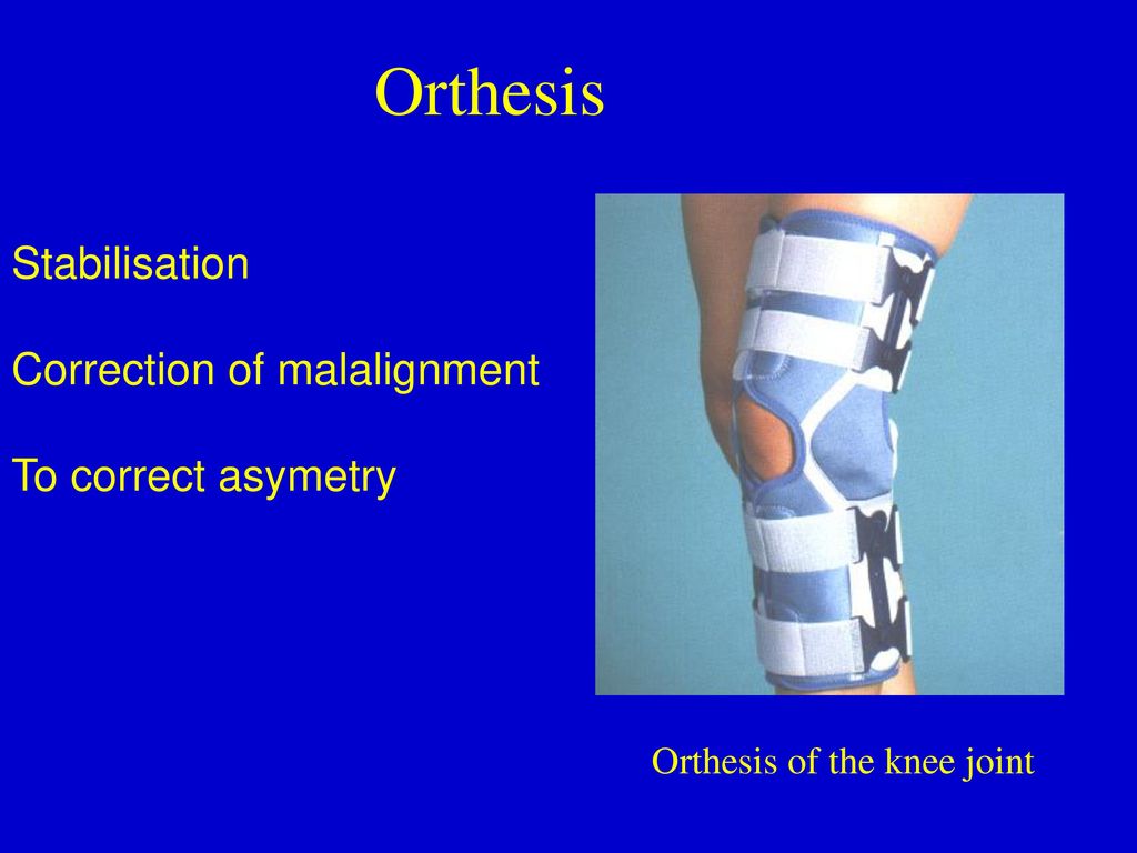Orthesis Stabilisation Correction of malalignment To correct asymetry