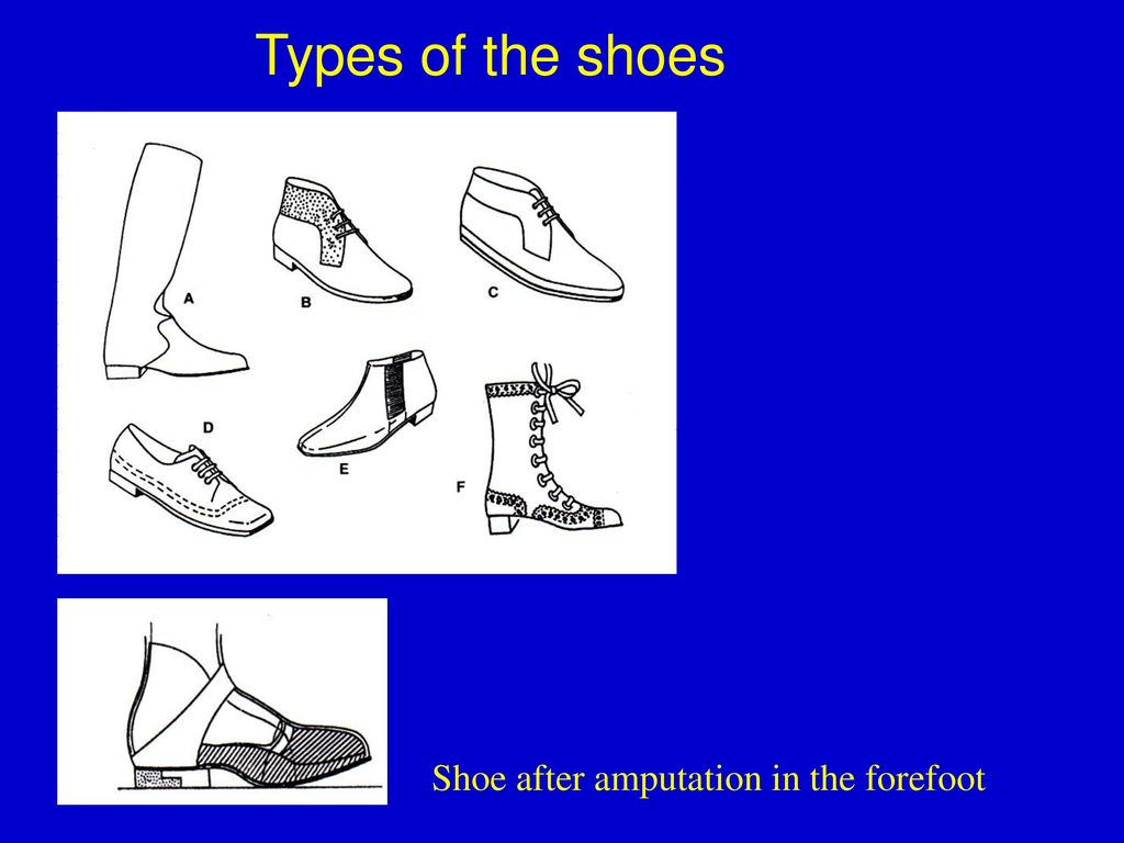 Types of the shoes Shoe after amputation in the forefoot