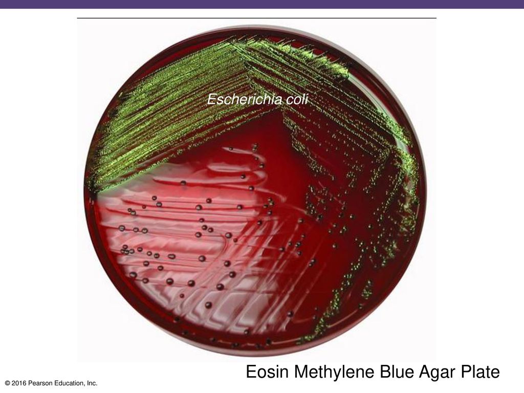 Eosin Methylene Blue Agar Plate.