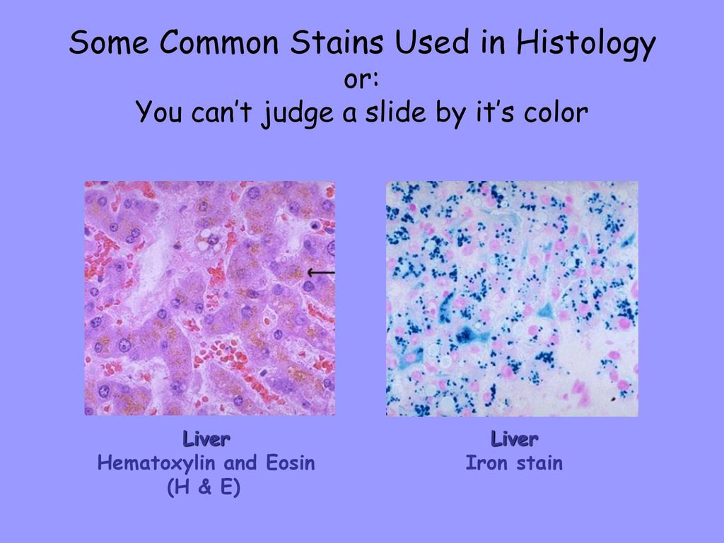 Some Common Stains Used in Histology or: You can’t judge a slide by it’s color