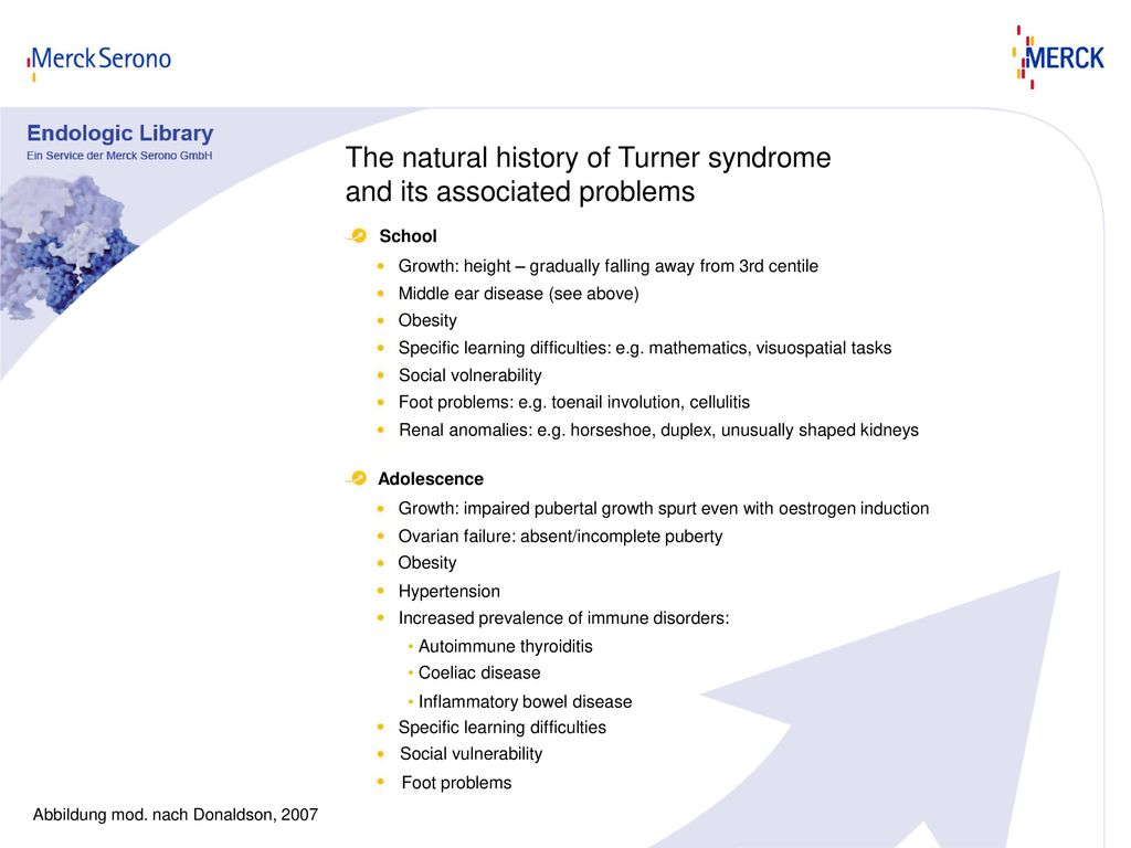 The Natural History Of Turner Syndrome And Its Associated Problems Ppt Download