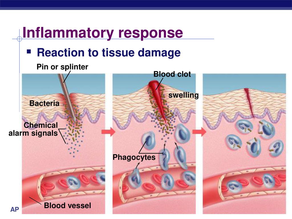 Fighting the Enemy Within! Immune / Lymphatic System Biology Diagrams