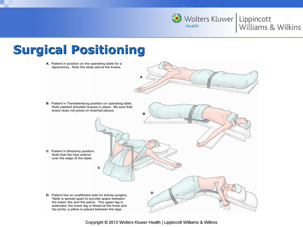 Perioperative Nursing - ppt download