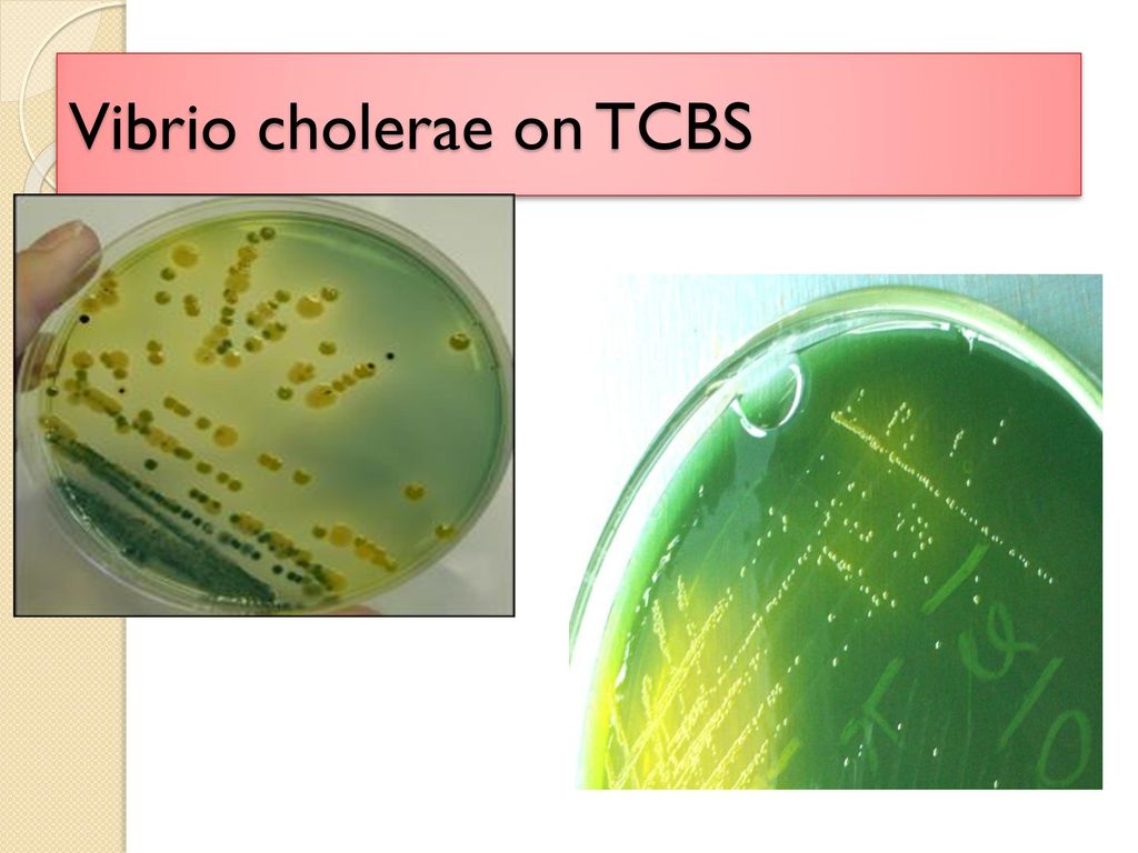 Известно что холерный вибрион вид подвижных. Холерный вибрион микробиология. Vibrio cholerae микробиология. Холерный вибрион на TCBS. Среда TCBS микробиология.