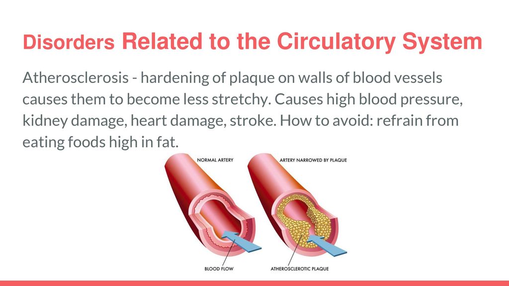 Disorders Related to the Circulatory System