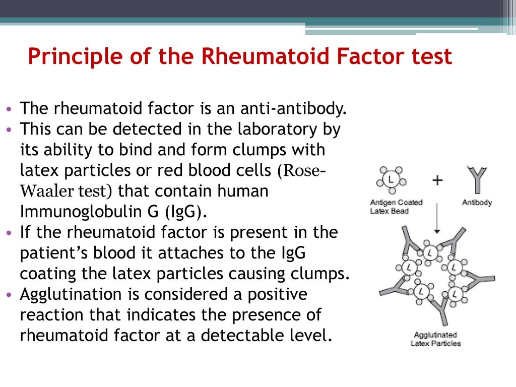 Rheumatoid Factor (RF) - ppt download