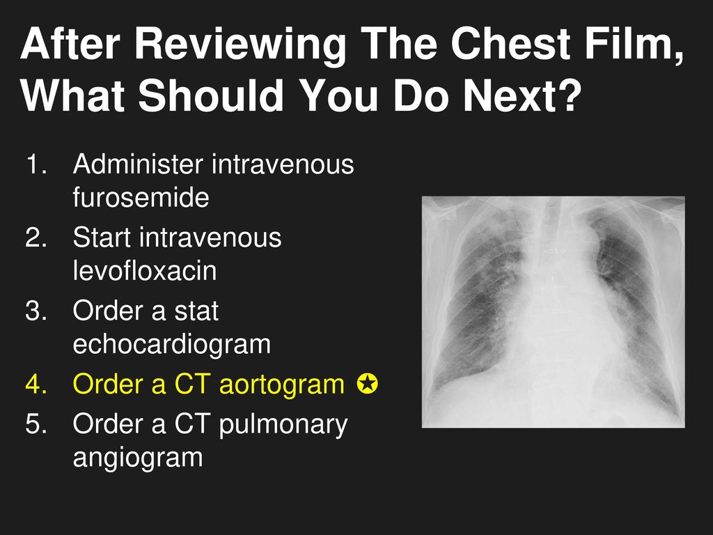 After Reviewing The Chest Film, What Should You Do Next