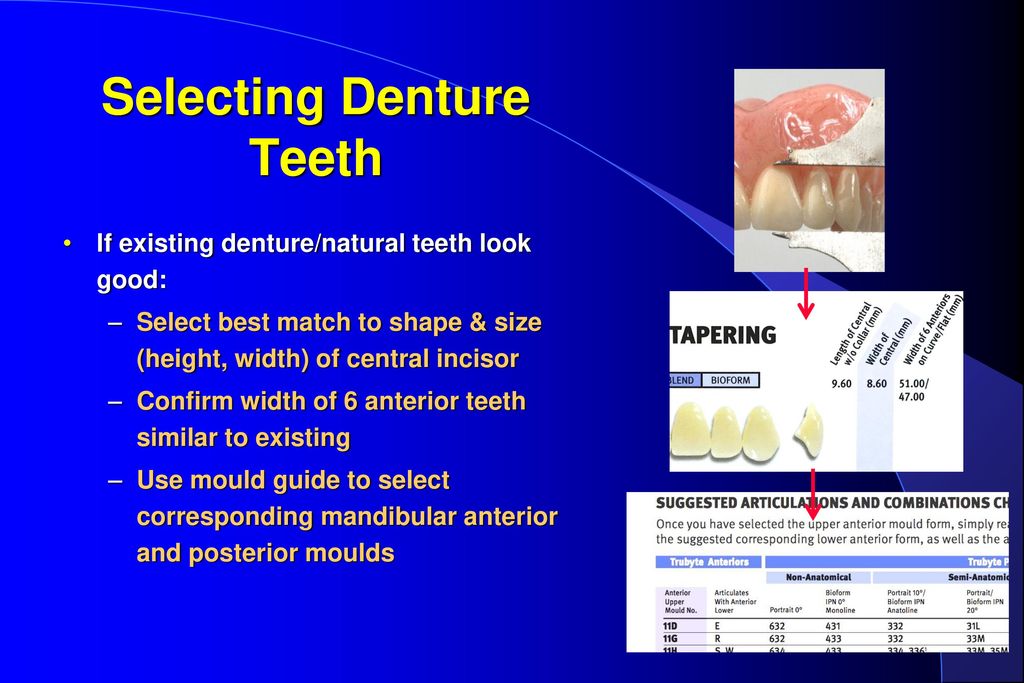 Denture Teeth Size Chart
