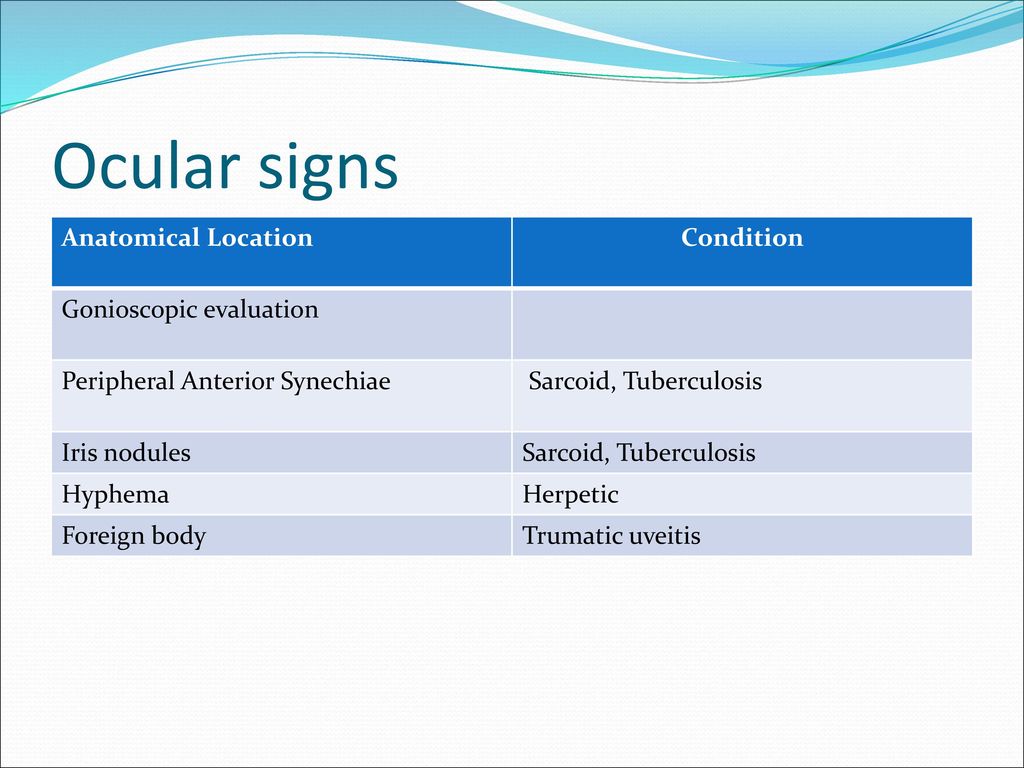 Ocular signs Anatomical location Condition Iris/Pupil