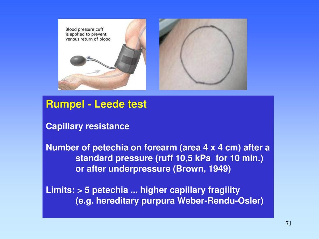 OF COAGULATION AND FIBRINOLYSIS ppt download OF COAGULATION AND FIBRINOLYSIS ppt download