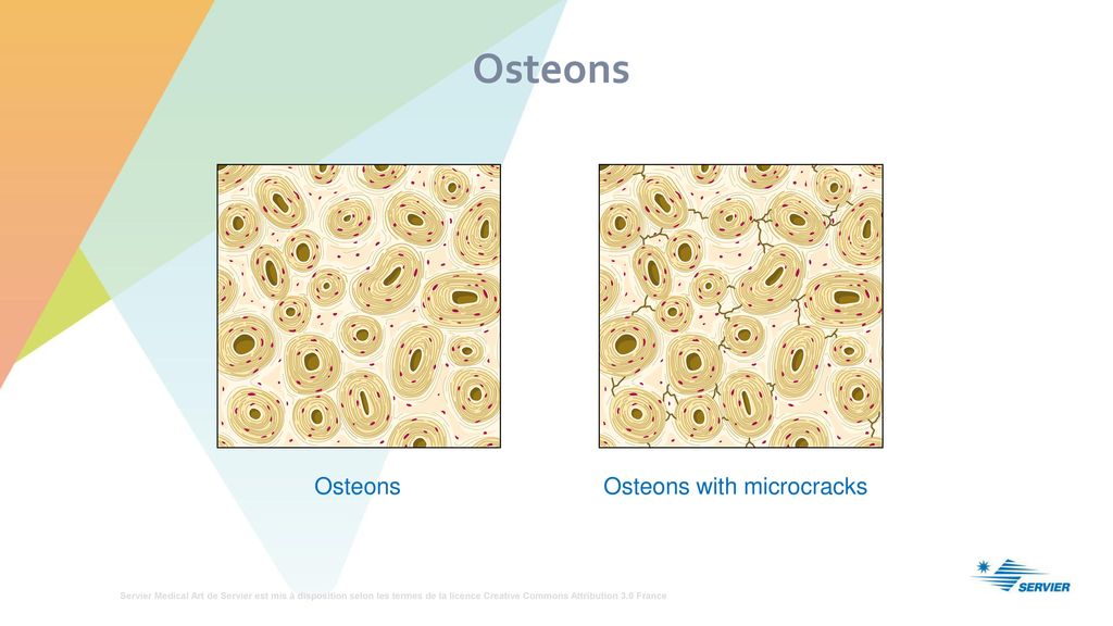 Osteons Osteons Osteons with microcracks
