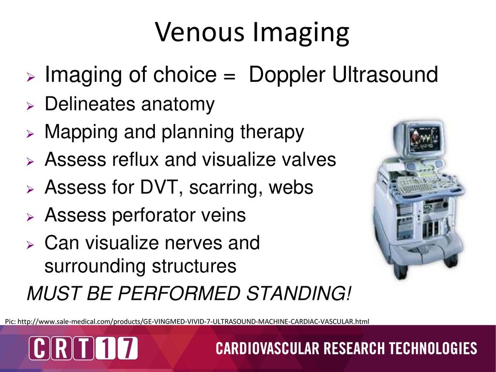 Venous Imaging Imaging of choice = Doppler Ultrasound