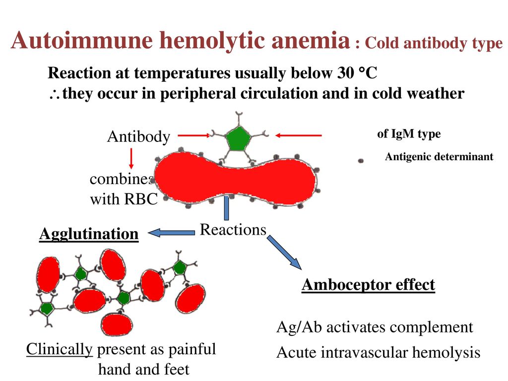 Autoimmune hemolytic anemia : Cold antibody type.