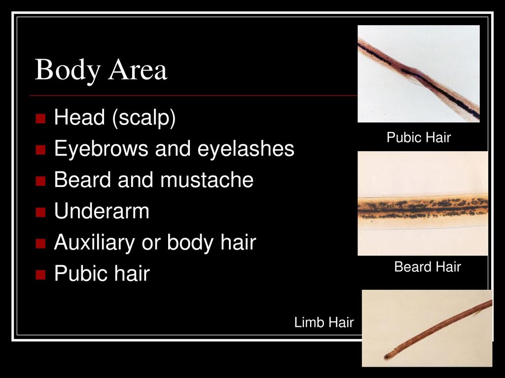 Hairs Trace Evidence. - ppt download