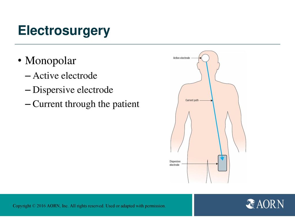 AORN Electrosurgery and Laser Guidelines: Shocking Changes - ppt download