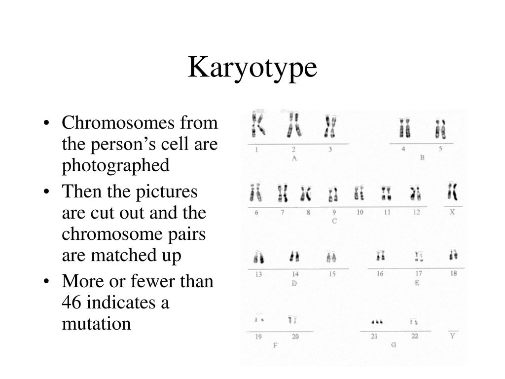 Karyotype Chromosomes from the person’s cell are photographed