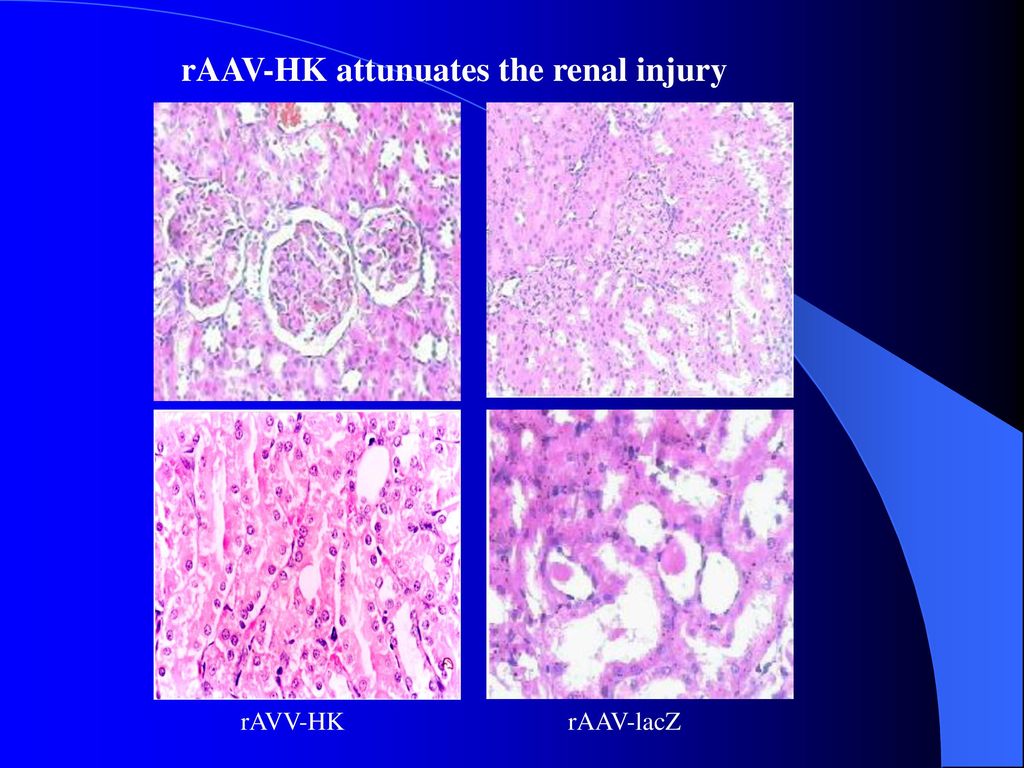 rAAV-HK attunuates the renal injury