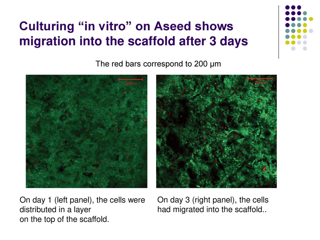 Culturing in vitro on Aseed shows migration into the scaffold after 3 days