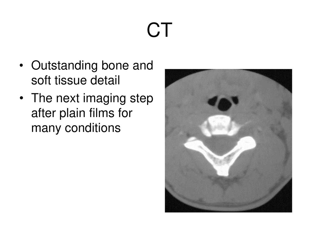 CT Outstanding bone and soft tissue detail