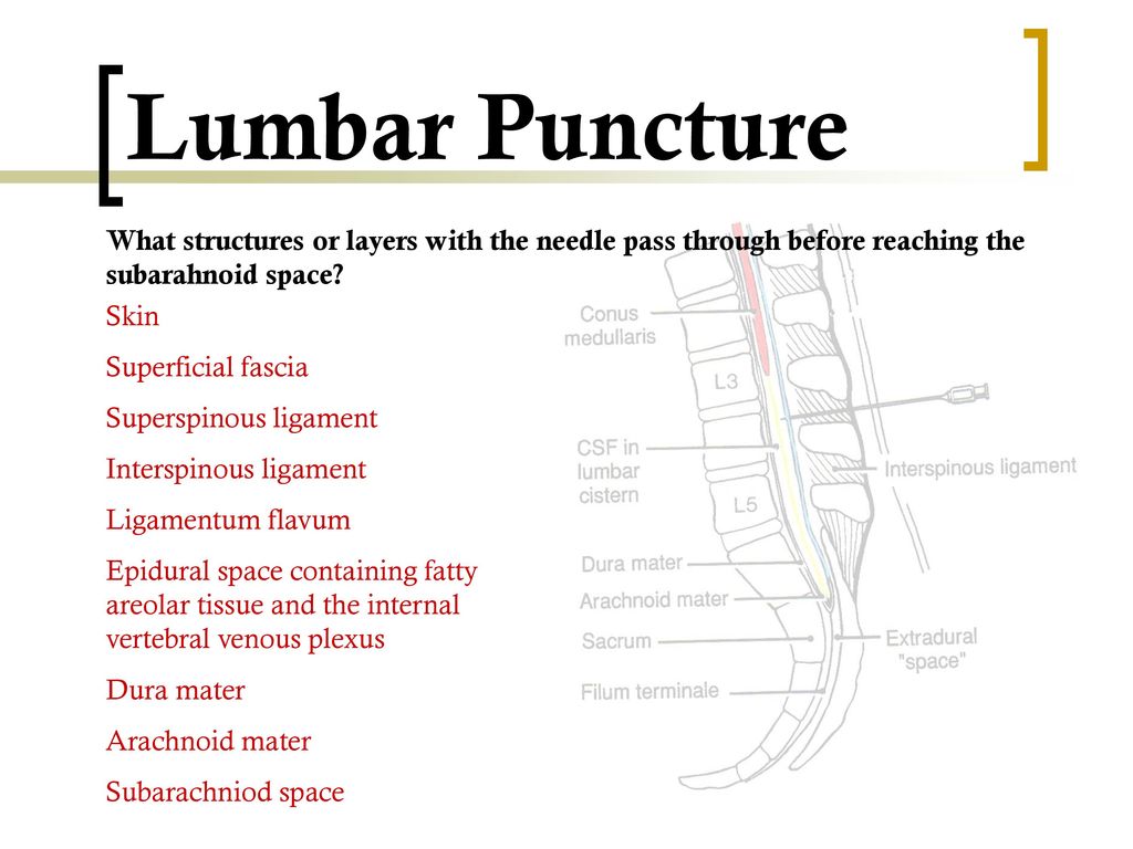 Lumbar Puncture Daryl P. Lofaso, M.Ed, RRT - ppt download Throughout Lumbar Puncture Procedure Note Template