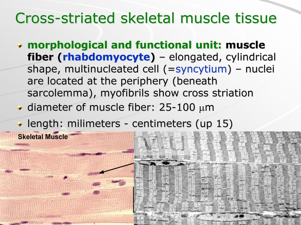 Muscle tissue 1) Striated skeletal muscle tissue. - ppt download