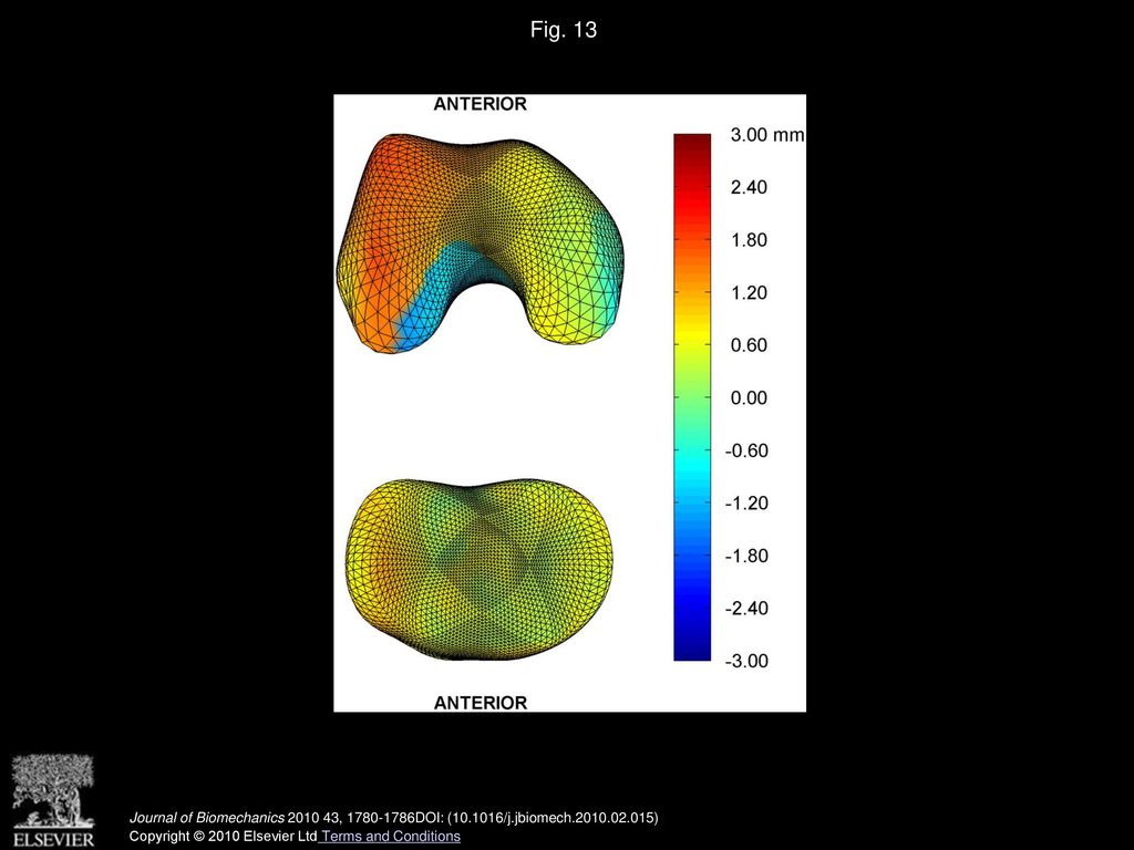 Fig. 13 Pointwise differences in average knee joint space between Control and Incidence groups.