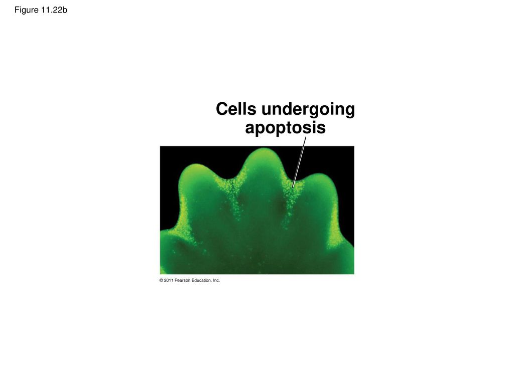 Cells undergoing apoptosis
